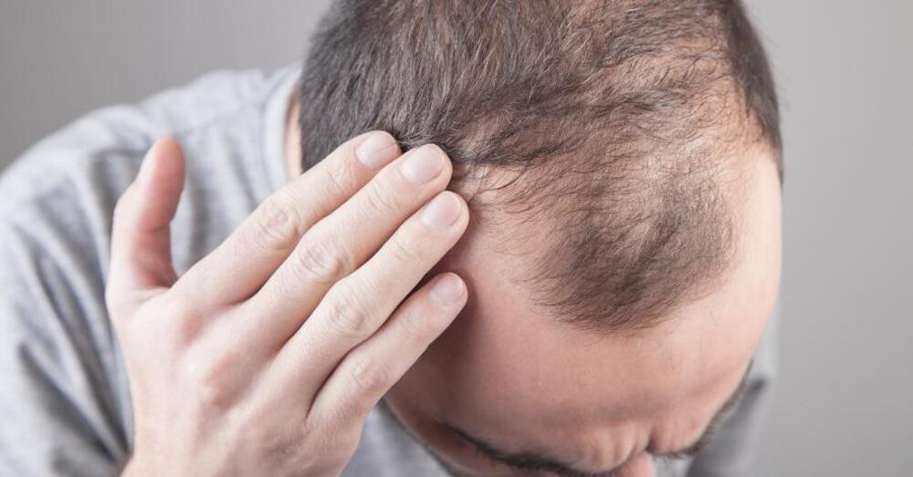 世界のヘアトリートメント薬市場、2033年には27億9,000万米ドル、年平均成長率7.14％