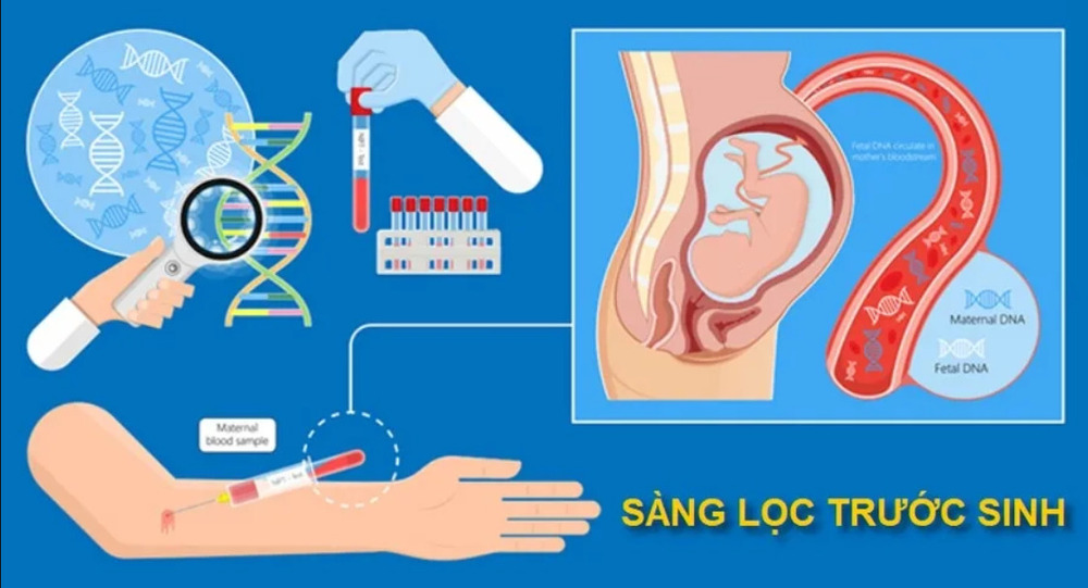 Vì sao kết quả sàng lọc trước sinh nguy cơ thấp vẫn cần theo dõi chặt chẽ?
