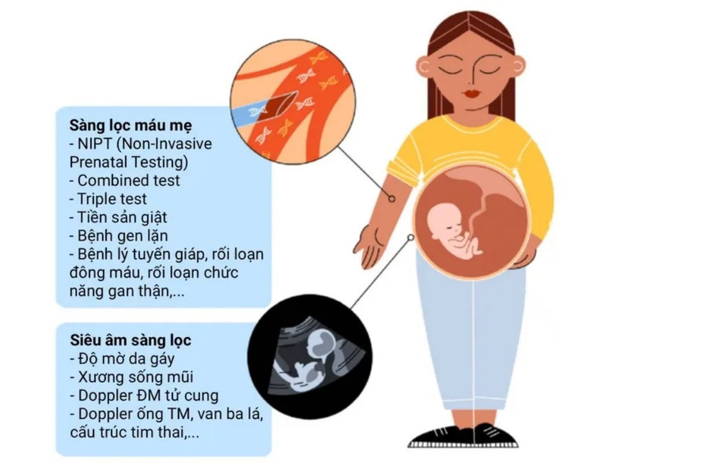 [Giải đáp] Xét nghiệm sàng lọc trước sinh giá bao nhiêu? 