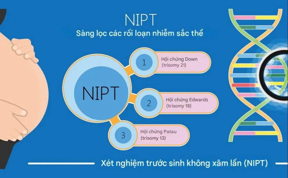 Xét nghiệm NIPT là gì? Lưu ý khi khám thai kết hợp xét nghiệm NIPT